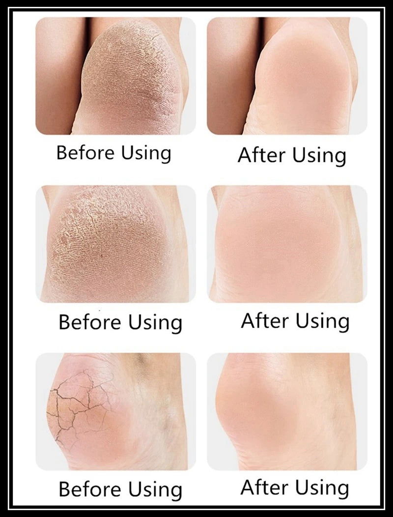 Silicone Feet Care Socks Moisturizing Gel Heel Thin Socks - China To BD Web