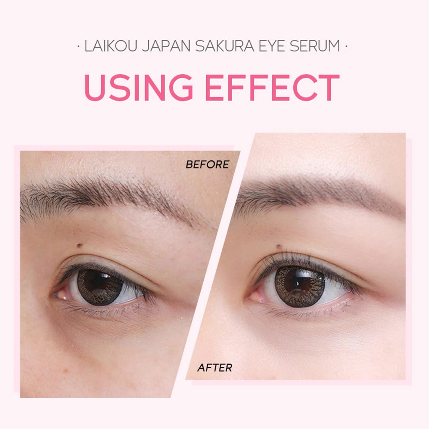 Laikou Japan Sakura Eye Cream🌸👀 - China To BD Web
