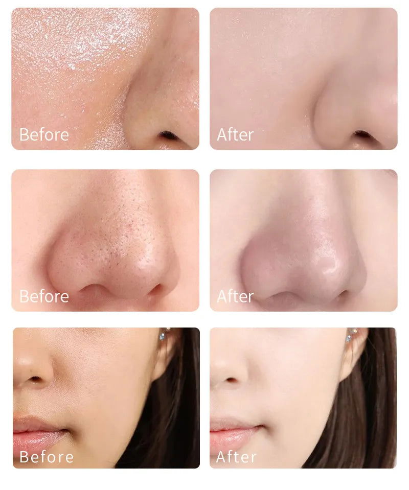 Melao Green Tea Mask Stick for Face Blackhead Remover Deep Pore Cleansing Brightening Facial Purifying Clean Matcha Clay Mud Mask - China To BD Web